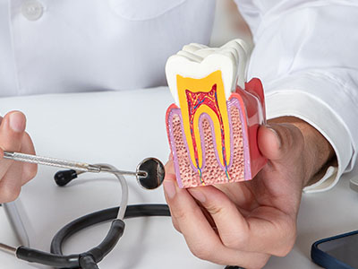 A healthcare professional holding a model of a tooth with an open crown, examining its interior while seated at a desk.